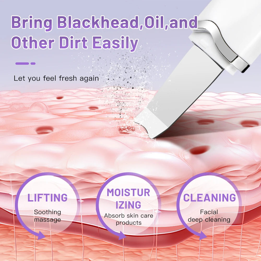 Luxury Ultrasonic Facial Cleansing Spatula – Peeling, Lifting and Blackhead Removal for Radiant Skin