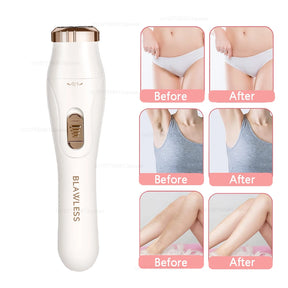 Deluxe Electric Epilator for Women – Portable and Painless Trimmer for Face, Legs, Underarms and Bikini Area
