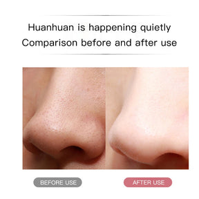 Luxury Ultrasonic Facial Cleansing Spatula – Peeling, Lifting and Blackhead Removal for Radiant Skin