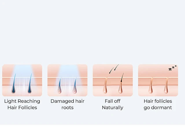 Luxury IPL Laser Hair Removal for Women – Permanent Hair Removal for Face and Body with Advanced Technology