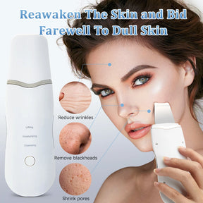 Luxury Ultrasonic Facial Cleansing Spatula – Peeling, Lifting and Blackhead Removal for Radiant Skin
