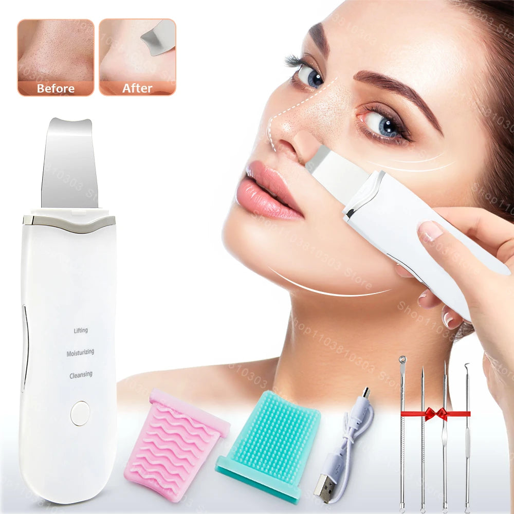Luxury Ultrasonic Facial Cleansing Spatula – Peeling, Lifting and Blackhead Removal for Radiant Skin