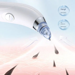 Electric Blackhead Remover Vacuum Suction – Deep Pore Cleansing and Premium Facial Care