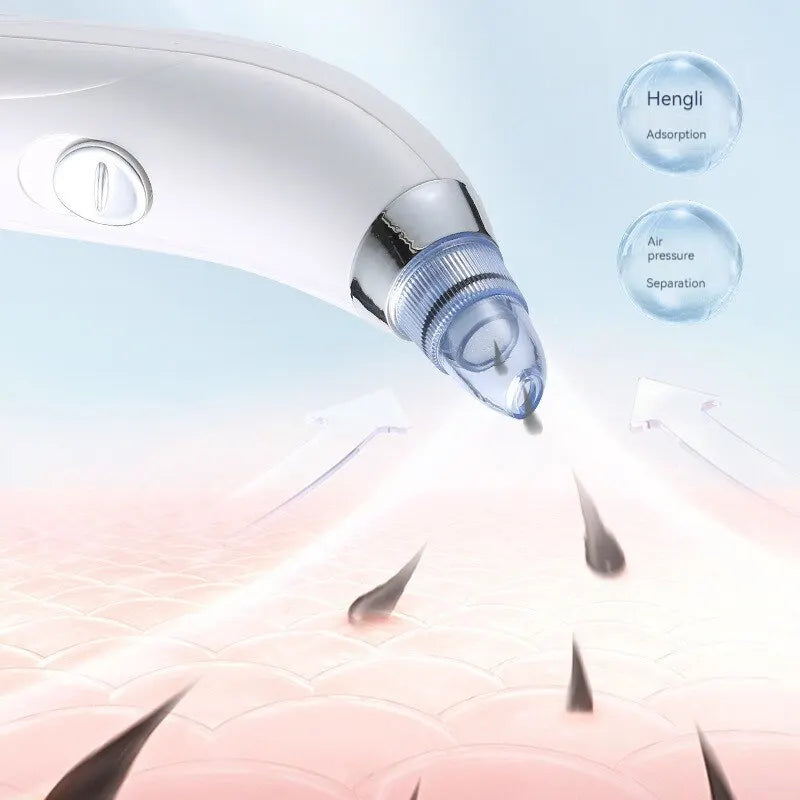 Electric Blackhead Remover Vacuum Suction – Deep Pore Cleansing and Premium Facial Care