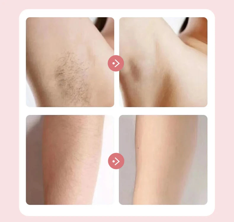 2-in-1 Electric Women's Trimmer and Epilator – Epilator for Face, Bikini, Underarms and Legs | IPX7 Waterproof