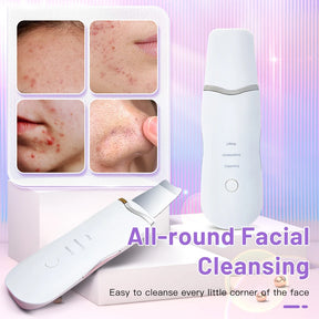 Luxury Ultrasonic Facial Cleansing Spatula – Peeling, Lifting and Blackhead Removal for Radiant Skin